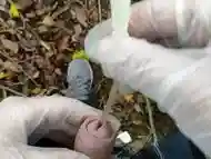 Autumn outdoor self catheter insertion, pee in forest