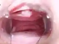 Extreme Pussy Close Up. Vaginal dilator