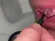 First time we use Vaginal Dilator for my Pee