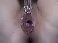 Milf examines the cervix. Deep vagina with speculum in hairy pussy. Homemade medical fetish close up. ASMR.